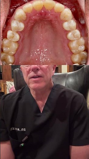 Lingual braces used to feel like a compromise, now they don't.