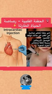 📌 الحقنة القلبية (Intracardiac Injection) 💉 ما هي الحقنة القلبية؟ هي طريقة طارئة لإعطاء الدواء مباشرةً داخل عضلة القلب، وتُستخدم فقط في الحالات الحرجة مثل توقف القلب أو تعذر إعطاء الدواء وريدياً أو عضلياً. ⚡ لماذا تُستخدم؟ لأنها توصل الدواء مباشرة إلى مجرى الدم دون الحاجة لامتصاص، مما يجعل المفعول أسرع. 🔹 أكثر دواء شائع الاستخدام: الأدرينالين (Epinephrine) بتركيز 0.1%، كونه أقوى منبّه للجهاز العصبي لعودة ضخ الدم. 🔹 الإبرة المستخدمة: إبرة بطول 4 بوصات لضمان وصولها إلى القلب. 🔹 مكان الحقن: عل