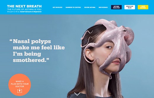 Understanding Nasal Polyps and Type 2 Inflammation