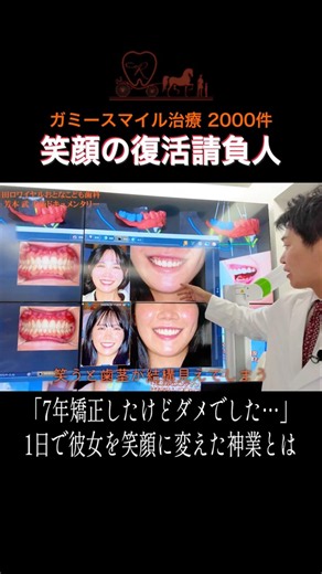 7年間のワイヤー矯正で改善が見られなかった女性をわずか1日で改善させたDr.芳本の歯冠長延長術！