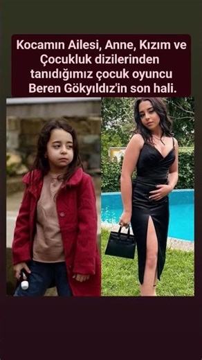 Kocamın Ailesi, Anne, Kızım ve Çocukluk dizilerinden tanıdığımız oyuncu Beren Gökyıldız'in son hali.