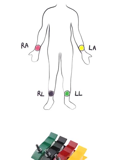 Électrodes Périphériques en ECG : Guide Complet