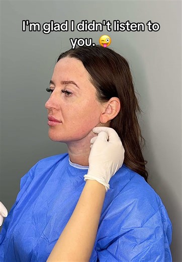 Double chin liposuction before and after result ✅‼️ best decision ever 🎉 ##chinlipo##chinliposuction##chinlipocheck##chinliporecovery##chinlipoupdate##doublechinlipo##doublechin##fyp##fypp##fypage##foryou##foryoupage##foryourpage#beforeandafter #beauty #viralvideo