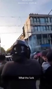 Moron destroys his hand with fireworks