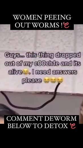 Did you know worms can cause itching under the skin ? Did you know worms can cause your booty hole to itch🪱 It’s not an itch you can scratch . You have to detox and kill them for this itch to stop. I’m not joking, y’all. They’re called pinworms, a type of parasite. Society has conditioned us to think parasites are a 3rd world country thing, but truth be told, they are not! You have them , your kids have them and so do your PETS ! According to US pharmacist, it’s estimated that pinworms affect 4