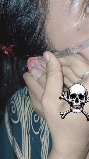Kesakitan dari Helix Piercing yang Menyengat