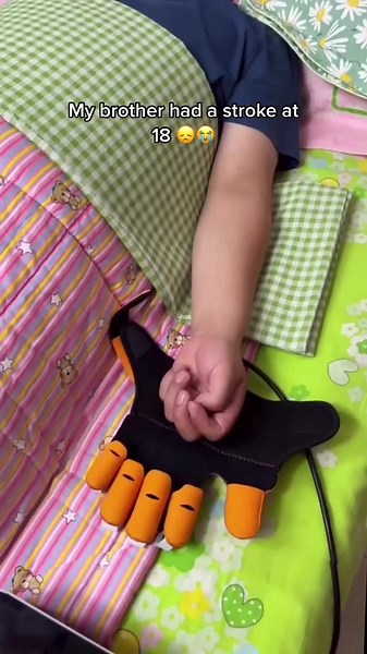 Innovative Prosthetic Hand for Stroke Recovery