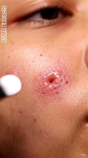 ASMR Extracts | Close Pore Vision