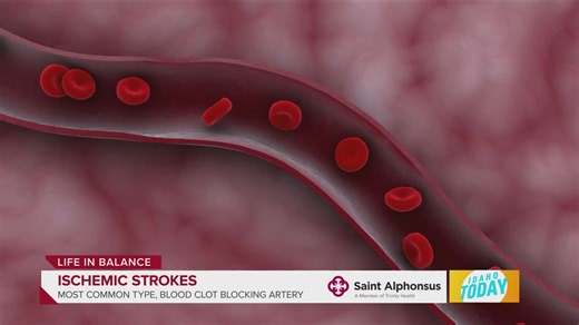BE FAST! Remember these signs of a stroke