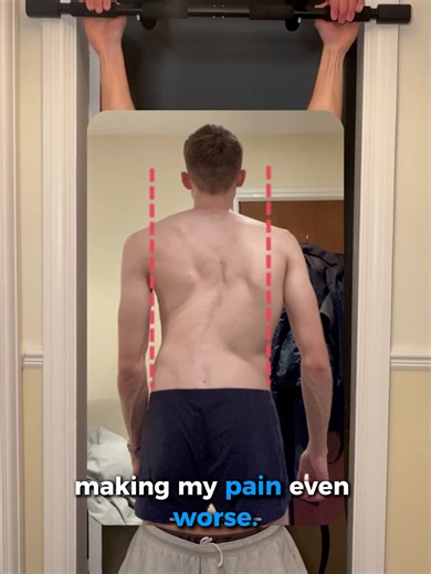 Exercise Safely with Scoliosis: Essential Tips