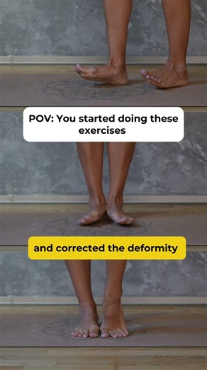 🔥 Simple Exercises for Alignment + Less Swelling + Better Posture 📥 GET THE WORKOUT