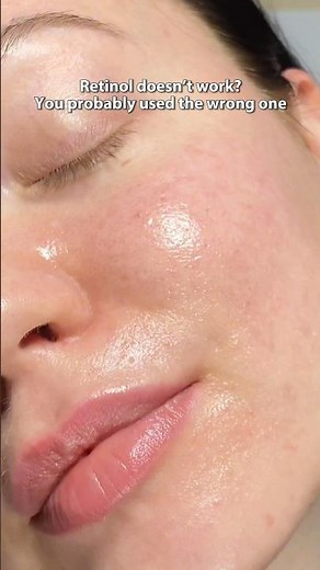 Retinol before and after | Real results, peeling, glow & how to use retinol for beginners