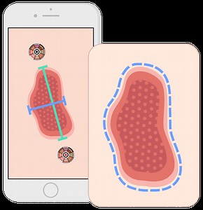 Digital Wound Management UK - Healthy