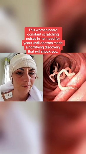 This woman heard constant scratching noises in her head for years until doctors made a horrifying discovery that will s | True Life Cases