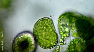 Seaweed (algae) under microscope, magnification 400x