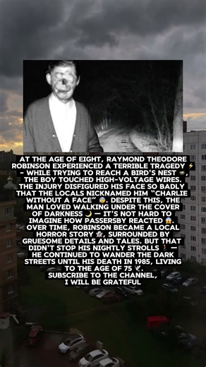 “Charlie Without A Face” Raymond Theodore Robinson #shorts #history #facts