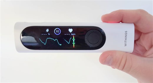 Withings BeamO review – Pickr