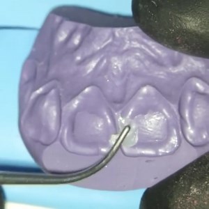 33K views · 520 reactions | Tips & Tricks. #Dentistry #LearningTips | Bites & Braces Dental | Facebook