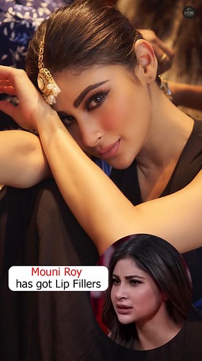 42K views · 2.2K reactions | Mouni Roy’s Lip Filler Transformation ...
