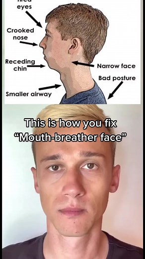 Improve Your Face with Good Habits: Mewing Tutorial