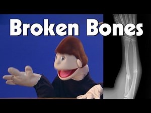 Broken Bones | Kids Health | The Friday Zone | WTIU | PBS
