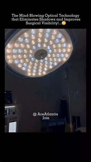 The Secret Trick Behind Shadowless Operating Room Lights!🤯 #SurgicalLights #MedicalTech #SurgeryTech