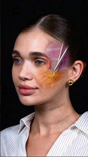 Endoscopic face lift, rhinoplasty, lip lift, eyelid surgery ⭕️ KAMINSKYI