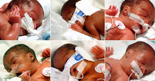 Parents of identical quadruplets join TODAY with their babies