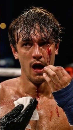 Bryce Hall's Unrecognizable Transformation #boxing #bkfc #shorts