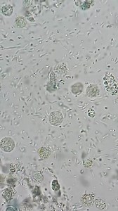 Leucocitos en muestra de orina. 🦠 #laboratorio #fypviralシ #paratiiiiiiiiiiiiiiiiiiiiiiiiiiiiiii #fypシ゚ #fypシ゚viralシ #fyp #nurse | Naun Toledo Parra