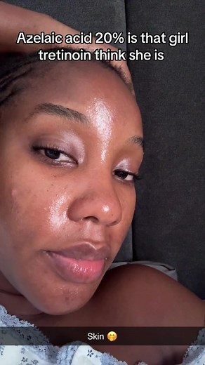 But know you must hydrate properly and have a good moisturizer #azelaicacid #tretinoin #skincare