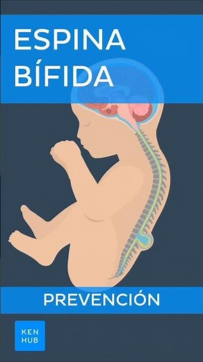 Espina bífida: Prevención | Kenhub #espinabifida