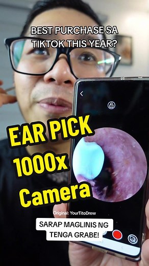 Ear Cleaning Camera: A Detailed Review