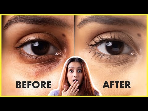 Remove Dark Circles Under Eyes Naturally At Home! Every Dark Circle Remedy | Glamrs