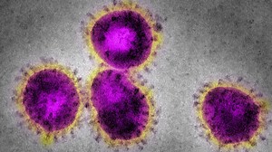 Experts call for new guidelines to address airborne diseases