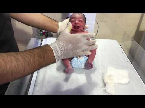 Reflax Oral for Newborns Baby Health Check Explained Injection & Oral Dose What Parents Should Know