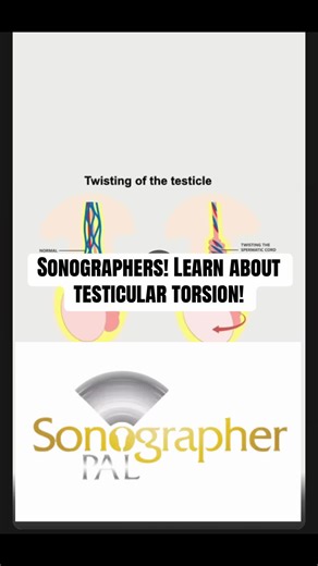 Testicular Torsion: Critical Ultrasound Insights for Exams