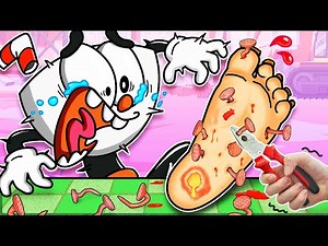 S O S❗ Cuphead Stepped On Nails || How To Athlete's Foot Treatment || Poppy Playtime Animation