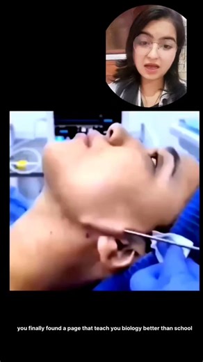 Shocking! Ye kya hai?? 😱 Chin Lipo Explained #shorts