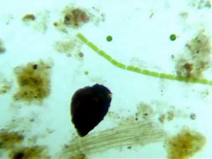 pond water under a microscope