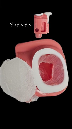 Cross sectional view of ADEX Endo tooth #adex #endo #root canal #dentalstudent #dentist #shorts