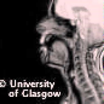 MRI voiced labial-velar approximant