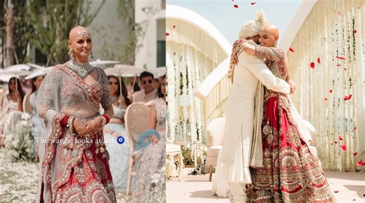 Indian Bride With Alopecia Ditches Wig, Breaks Beauty Norms; Embraces Bald Look In Heartfelt Wedding Video, Watch