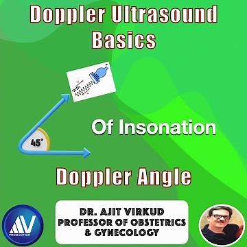 Doppler Ultrasound Basics 02: Angle of Insonation