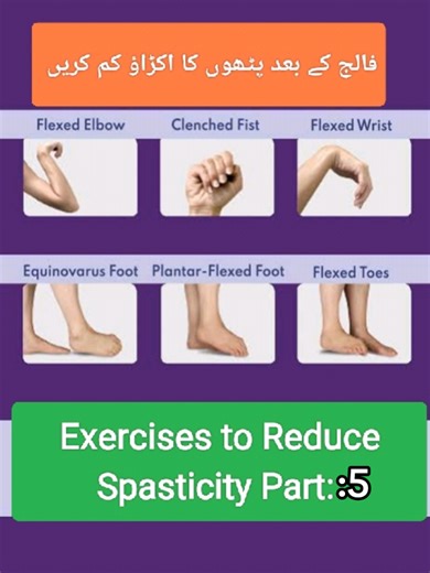 Bilateral Diagonal Pattern for Stroke Rehabilitation