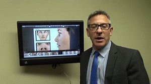 What is the Typical Recovery Like After Rhinoplasty?