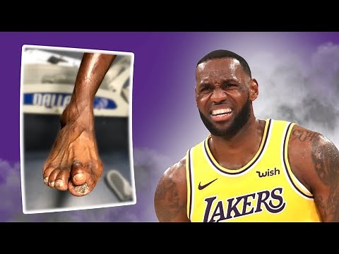 NBA Players have the NASTIEST Feet