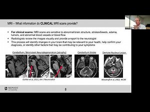 All About Imaging: CT, MRI, and PET | PrepRARE Video