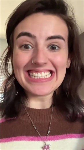 Invisalign before and after transformation