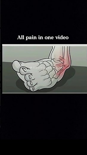 All pain in one video 😂 #relatable #funny #youtubeshorts #viralvideo #edit